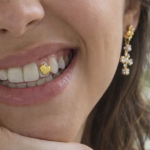 reseña joyas dentales - 2