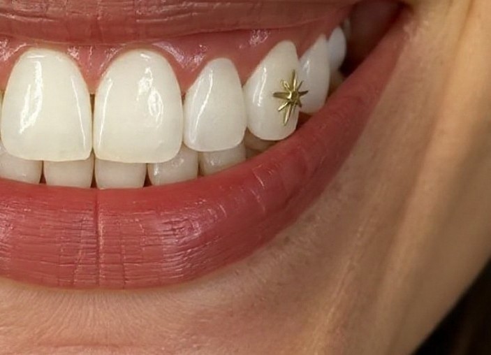 limpiar dientes con tooth gems