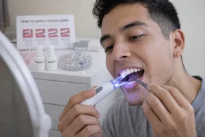 tooth gem duración