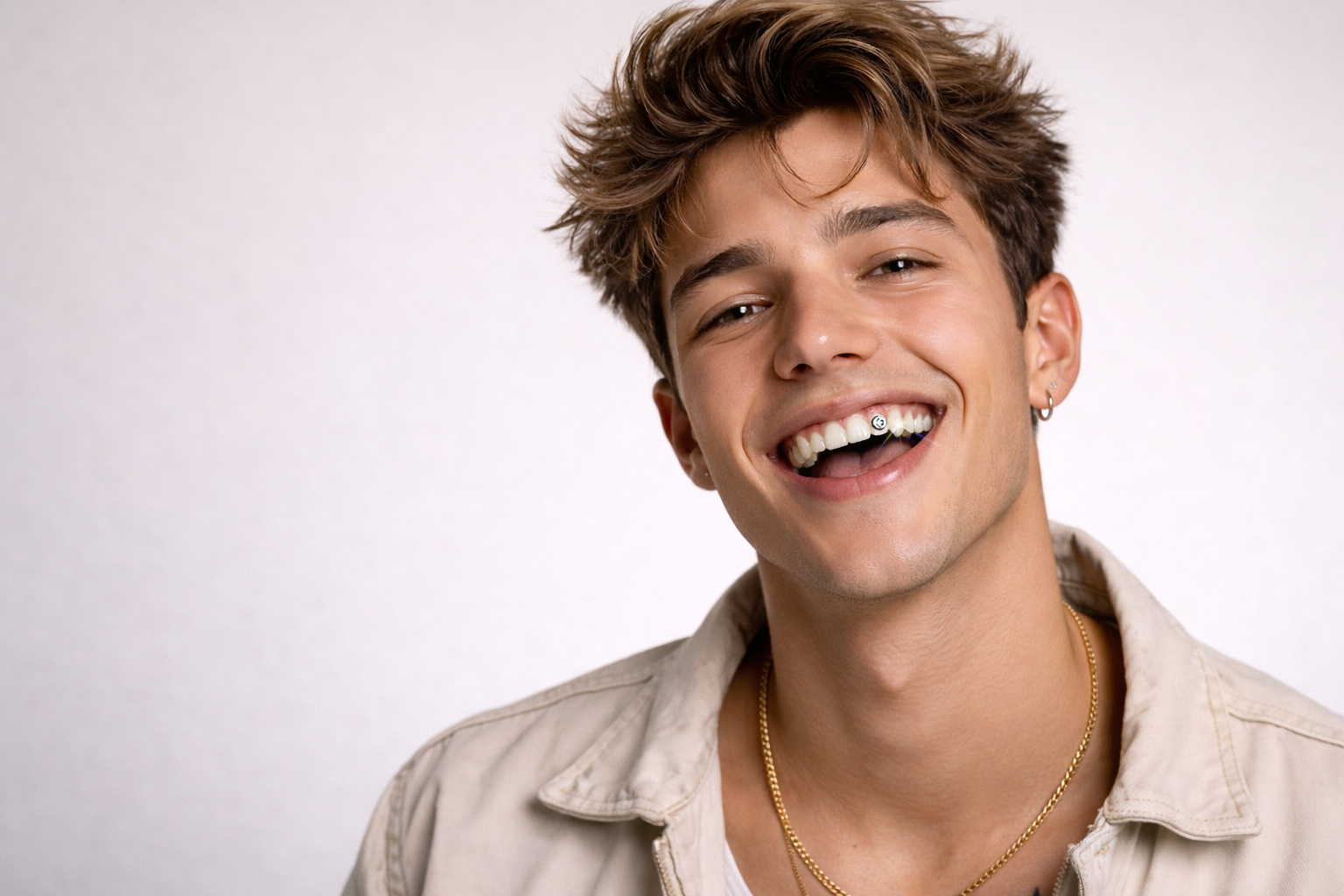 tooth gems en dientes delanteros o laterales