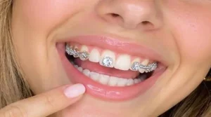 tooth gems y alimentos