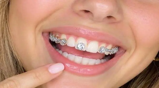 tooth gems y alimentos